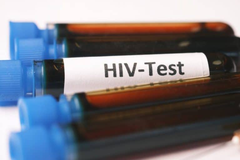 HIV 11.1