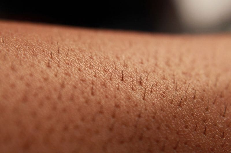 SKIN 25